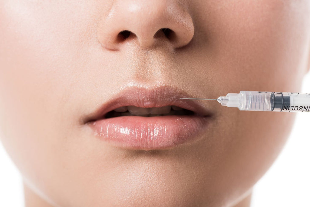 The Benefits of Hyaluronic Acid Lip Fillers